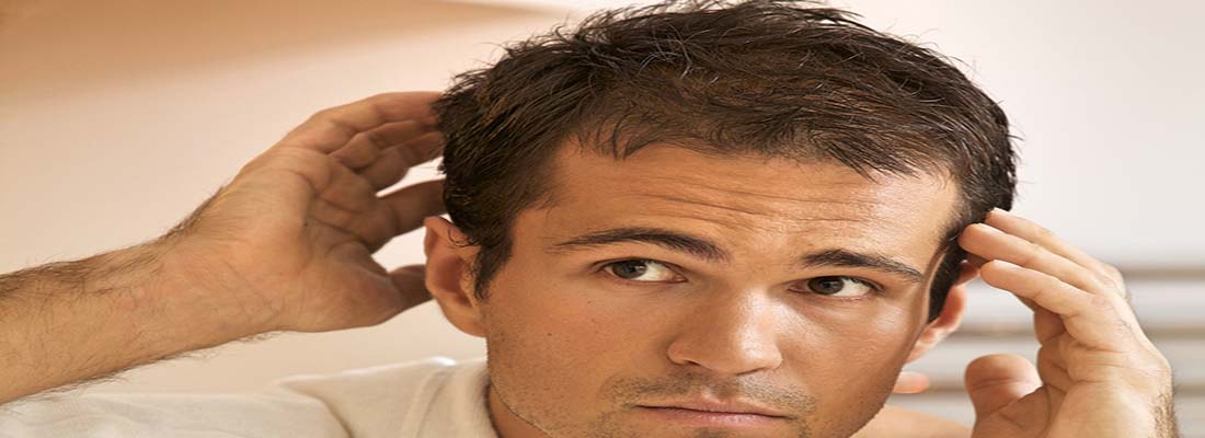 Hair Loss Treatment | Fresno, CA - Fresno Hair Solutions