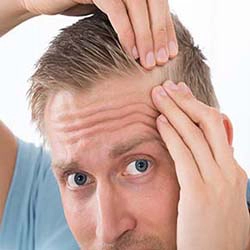hair loss treatment
