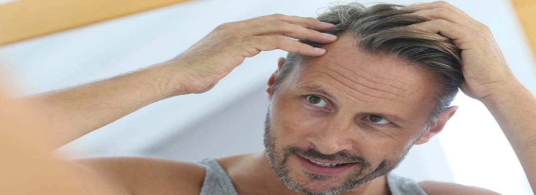 hair loss treatment